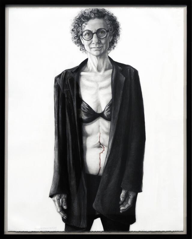 Portrait of woman with shirt open, showing scar on her abdomen